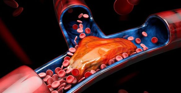 Saiba o que são as dislipidemias e como as pode prevenir