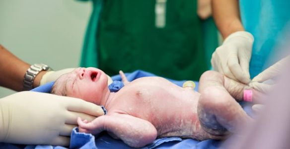 O que é o Índice de Apgar?